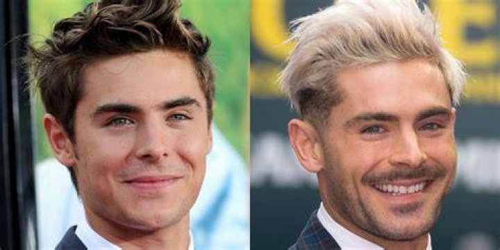 10 Celebrities Who Bleached Their Skin (Before and After Photos) Tuko.co.ke