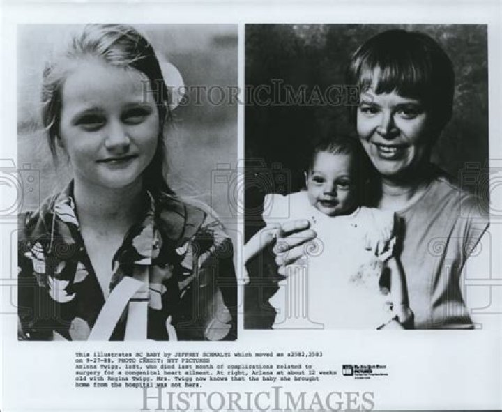 1988, Arlena Twigg who died of a congenital heart condition. Historic