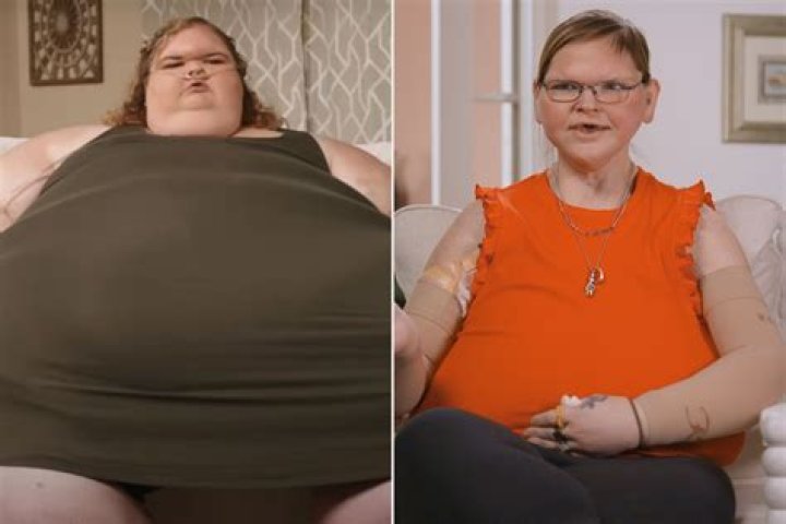 500Pound Woman Had to Lose 300 Pounds or Suffer Pain for Rest of Her