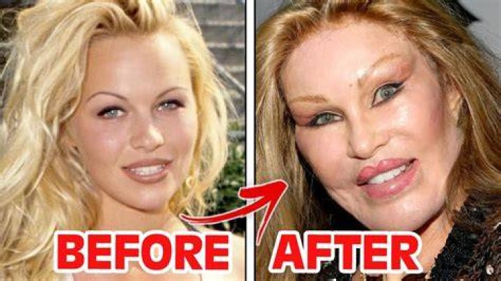 90 Day Fiance star Natalies before and after plastic surgery pictures explored Mon 28 J |