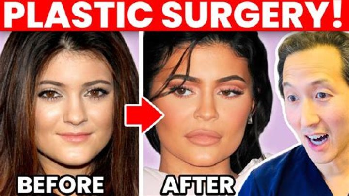 Ari from 90 Day Fiancs plastic surgery rumours explored Mon 25 October 2021 11:03 Helen |