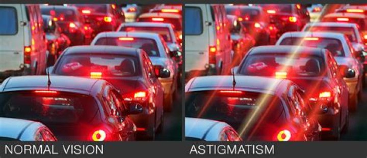 Astigmatism Vision
