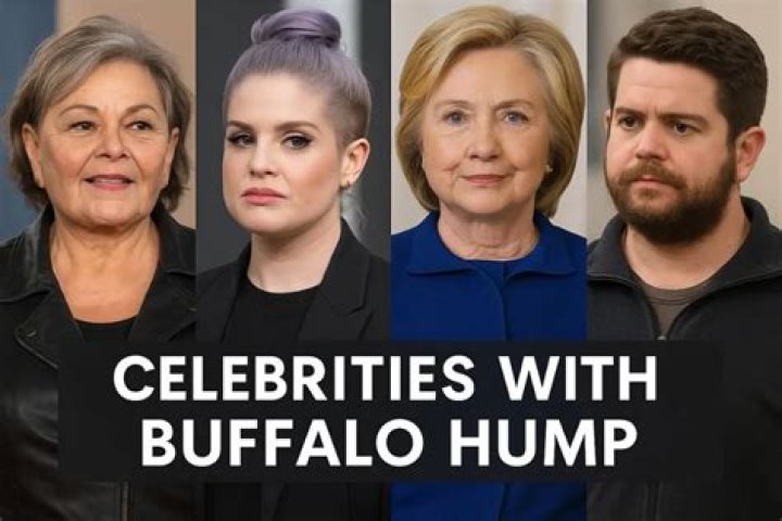 Celebrities with Buffalo Hump A Surprising List Revealed