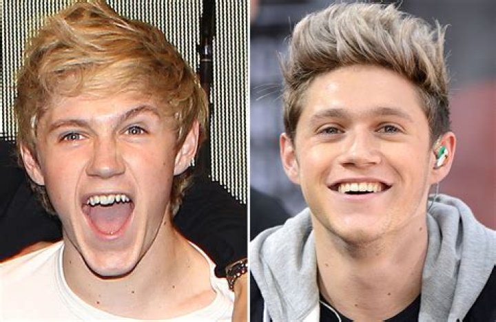 Celebrity smile transformations Irish Mirror Online