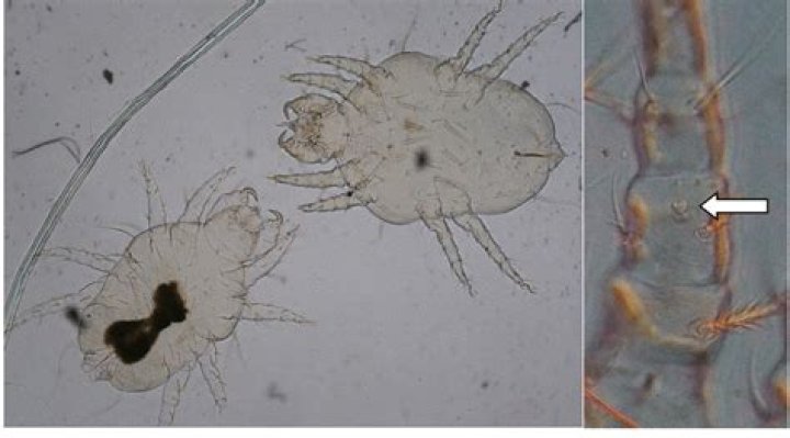 Cheyletiella yasguri from a dog (Prostigmata Cheyletiellidae). Dogs