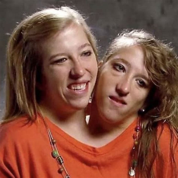 Conjoined Twins Abby and Brittany's Exciting News! Trendy Matter