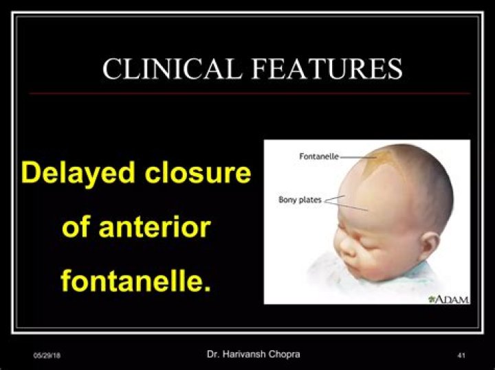 Delayed Fontanel Closure, Raccoon-cooper