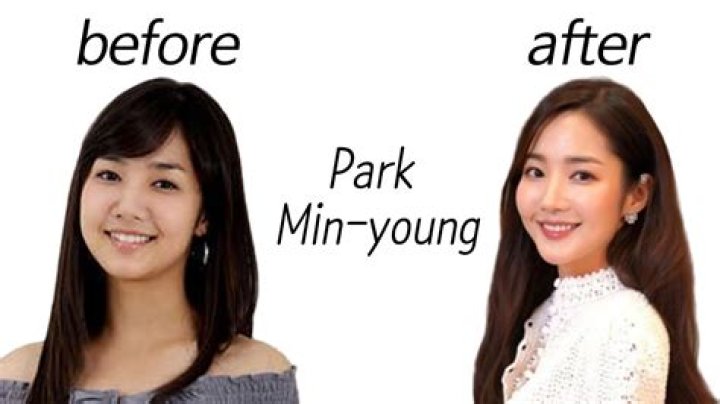 Did Park Min Young Have Plastic Surgery? Park Min Young Before and After