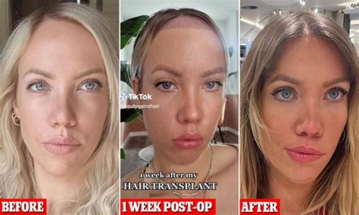 Did The Day Shift Cast Really Undergo Other Procedures Besides Eyebrow Transplant?