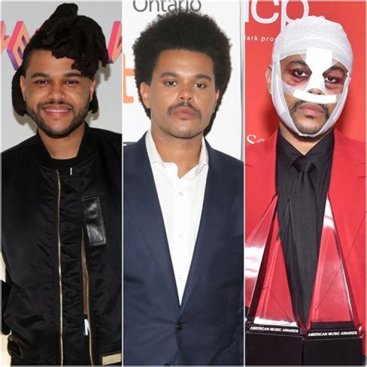 Did The Weeknd Get Plastic Surgery? Find Out Here ·