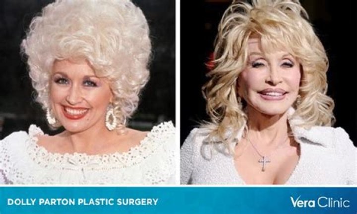 Dolly Partons Plastic Surgery Chronicles: A Journey of Beauty and Bravery