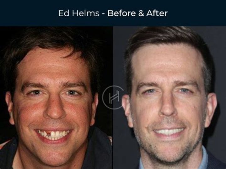 Ed Helms Photos Photos Ed Helms at the Airport Zimbio