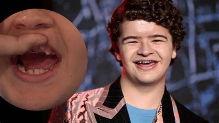 Famous People With CCD, Raccoon-cooper
