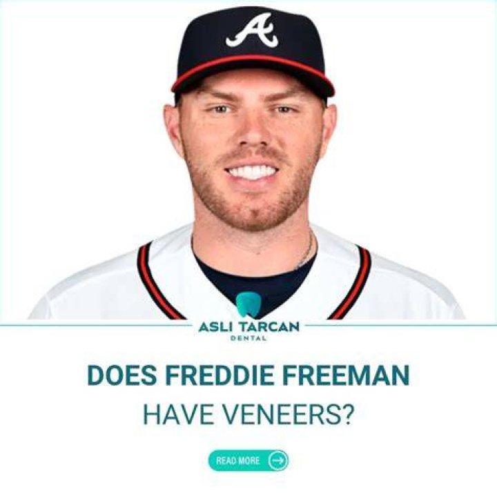 Freddie Freeman on the Braves’ strange season, his contract and his