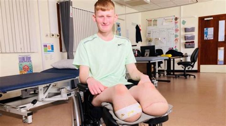 How Did Ray Barnett Lose His Legs On ER? Here’ What Happened Exactly ·