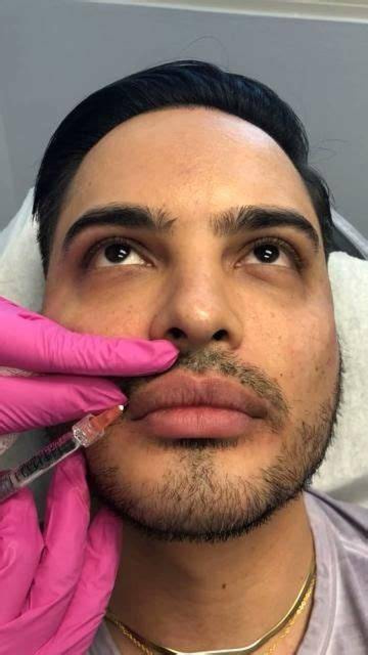 Injecting the lips Copy Copy Enhance Me Training Academy