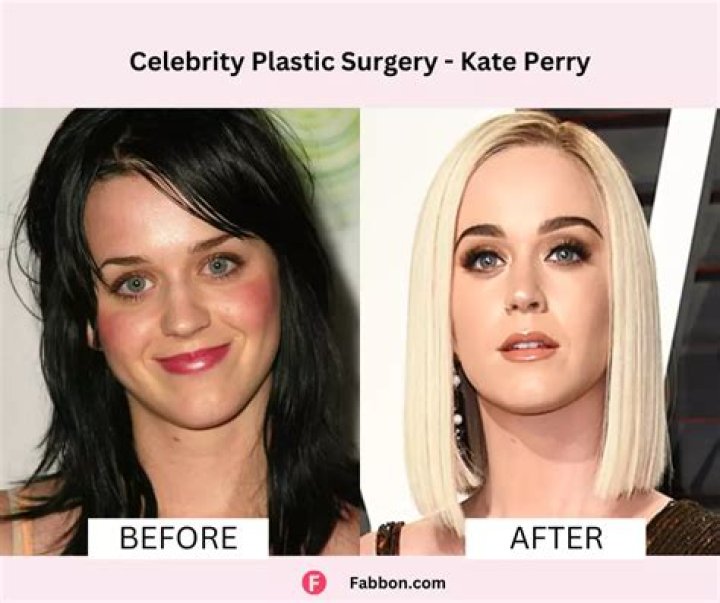 Is Cynthia Nixon Plastic Surgery? Before and After