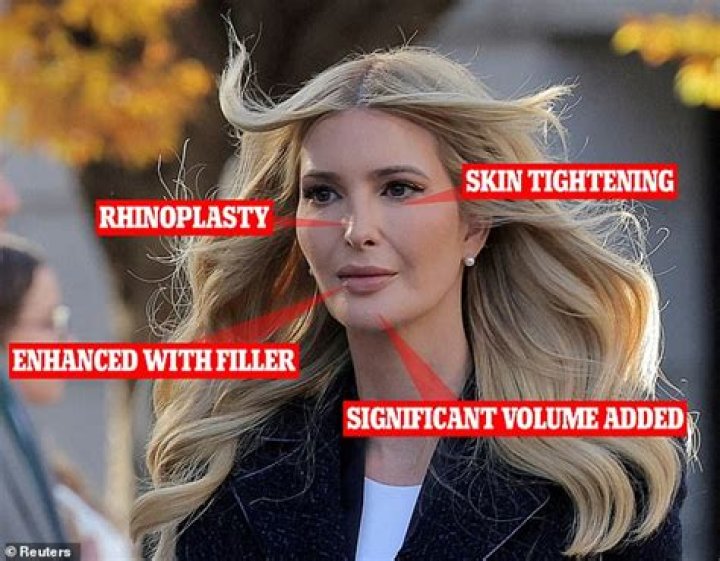 Ivanka Trump Had Plastic Surgery