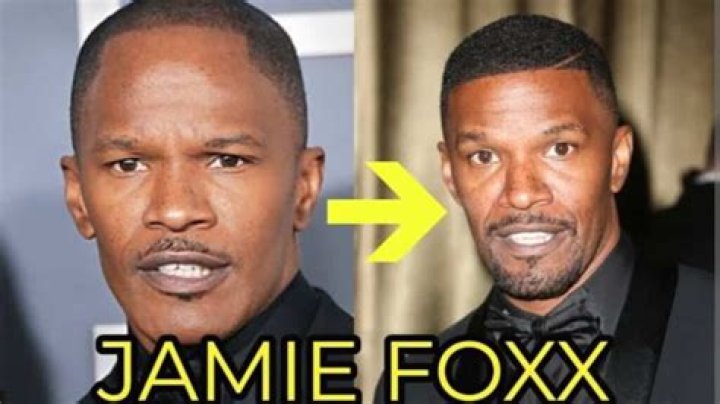 Jamie Foxx Weight Loss Before And After Photos