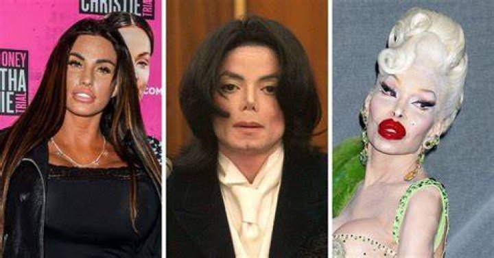 Kate Chastain Might Have Gotten More Plastic Surgeries than She Admits