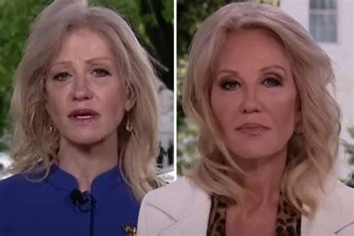 Kellyanne Conway Is After GlowUp — Did She Have Plastic