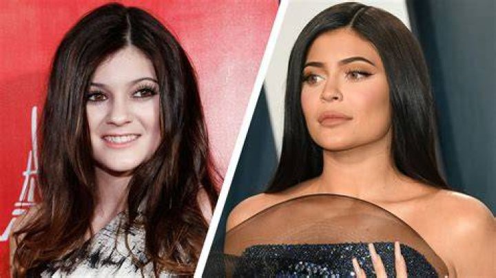 Kylie Jenner, Before and After Transformation