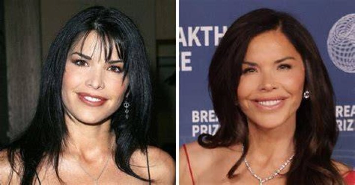 Lauren Sanchez No Makeup Did She Had Plastic Surgery?