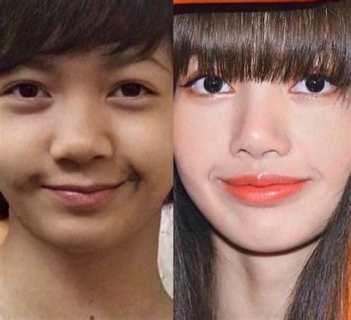 Lisa Before Plastic Surgery Unveiled