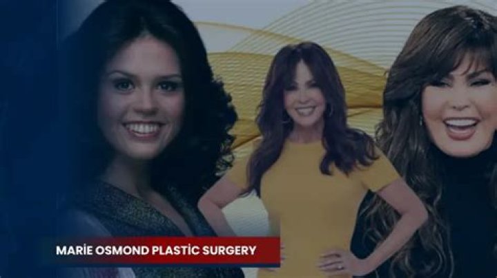 Marie Osmond Plastic Surgery: How She Maintains Her Youthful Looks 1 Marie Osmond Plastic Surgery: How She Maintains Her Youthful Looks