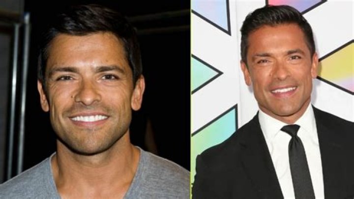 Mark Consuelos' Plastic Surgery Journey
