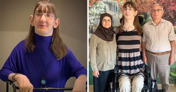 Meet Rumeysa Gelgi, the 25-Year-Old Who Is the Tallest Woman on Earth