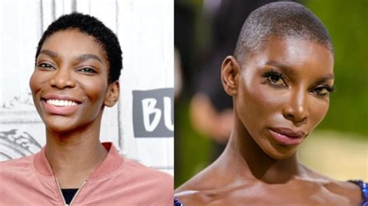 Michaela Coel Before And After Surgery, Plastic Surgery