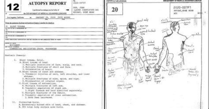 Moonbin Autopsy Report What did Police Say About His Sudden Deἀth