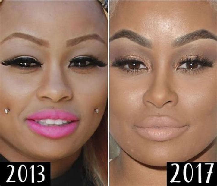 Plastic Surgery? See Blac Chyna's Body Change Over Time
