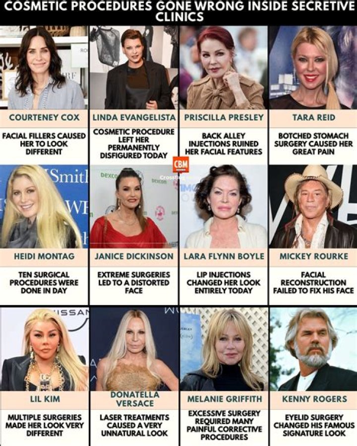 Reason Behind Courteney Cox’s Botched Plastic Surgery!