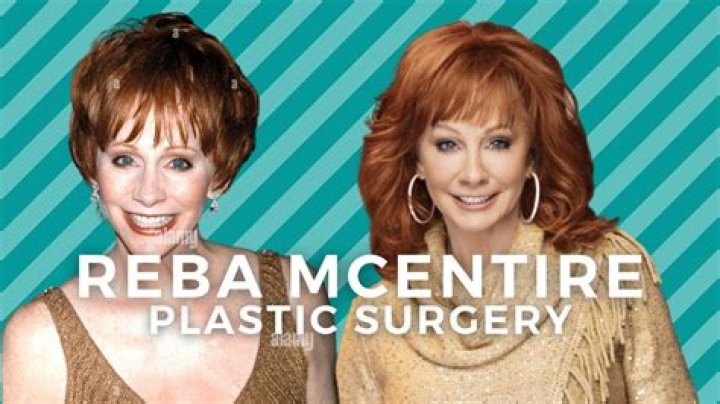 Reba McEntire Plastic Surgery? See Her Transformation