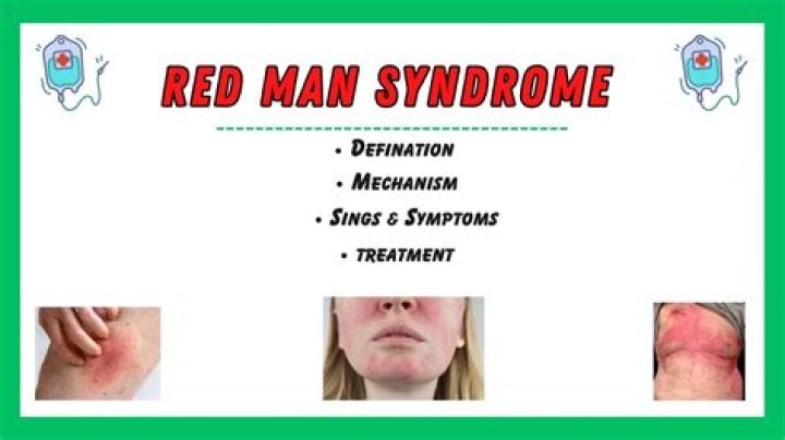 Redman Is The Popular American Rapper Sick? Here Is What We Know About