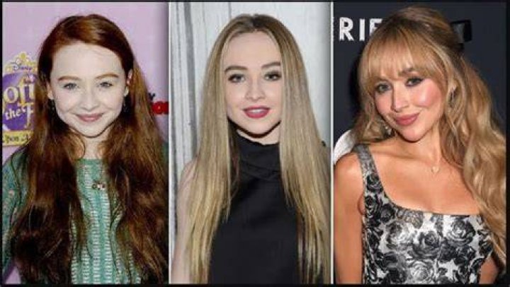 Sabrina Carpenter Plastic Surgery Fans Suspect Botox