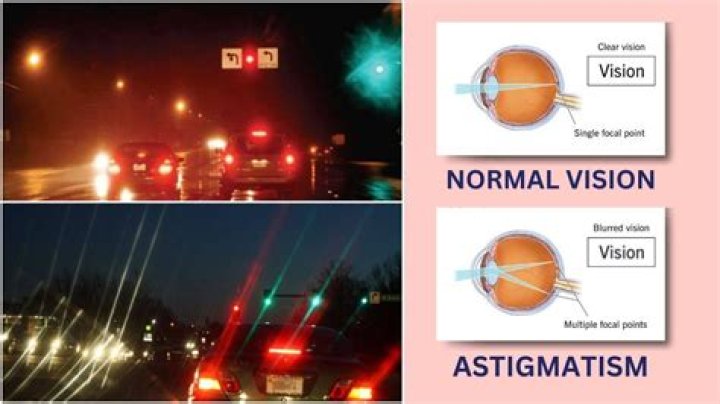 So if u have astigmatism, then this is what lights look like to you. I