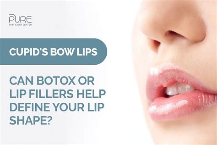 The Cupid&rsquo;s Bow Lip Treatment Aestha Clinic