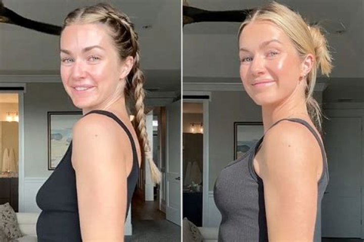 TikToker Alix Earle Tells All About Her Breast Augmentation