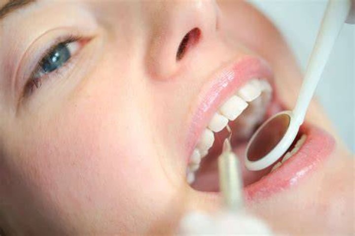 Treatment Options For Fixing a Gap Between Teeth Tompkins Dental