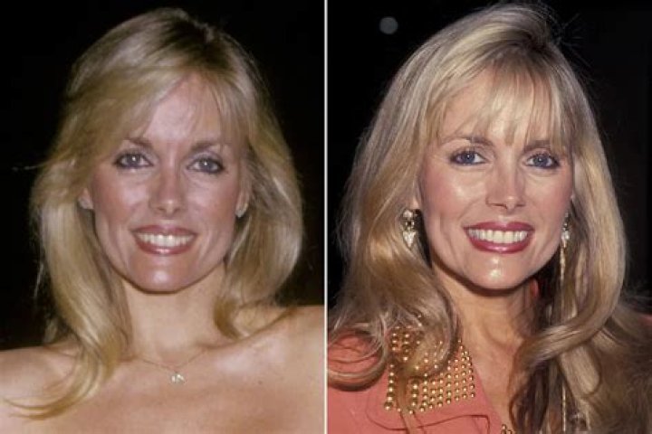 Unveiling The Allure: Dian Parkinson's Playboy Legacy