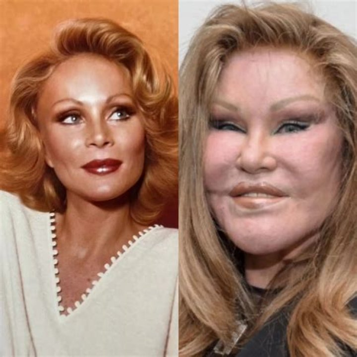 Unveiling The Enigmatic World Of Jocelyn Wildenstein: Beauty, Identity, And Transformation