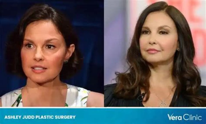 Unveiling The Truth Behind Ashley Judd Plastic Surgery