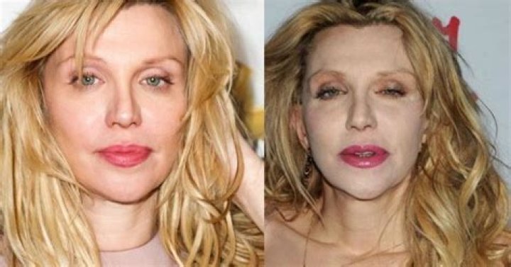 Weird Looking Celebrities After Plastic Surgery