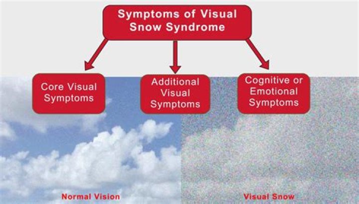 What is visual snow syndrome? Bryan Kohberger Tapatalk forum posts go viral online |