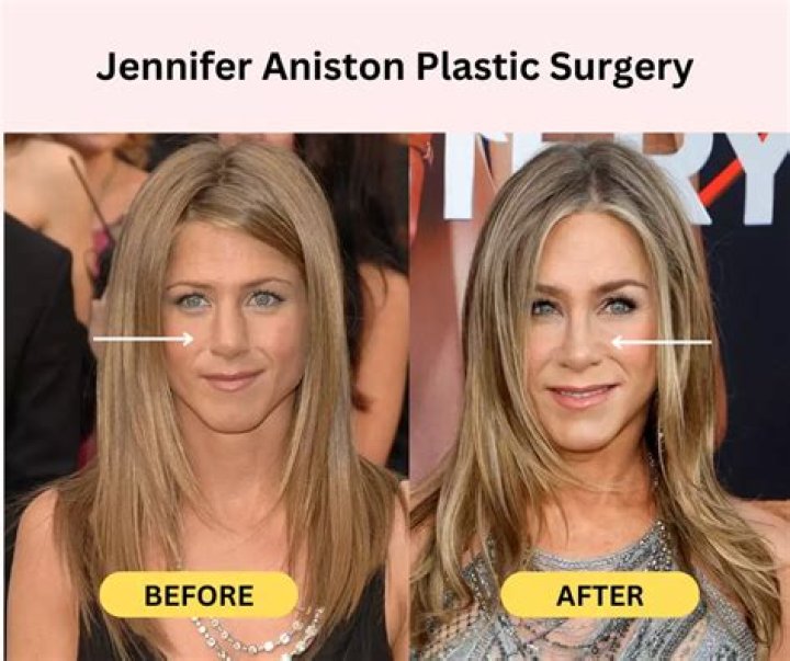 What Plastic Surgery Has Shannon Bream Gotten? Body Measurements and